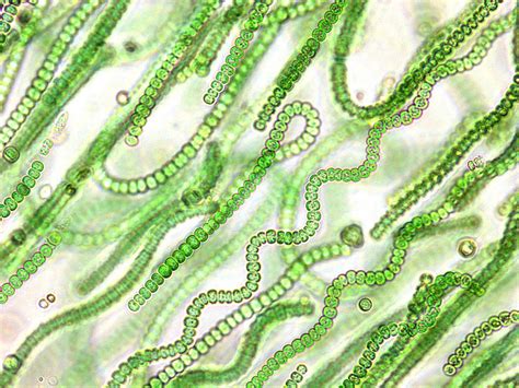 Cyanobacteria | Microscopic photography, Photosynthesis, Bio art