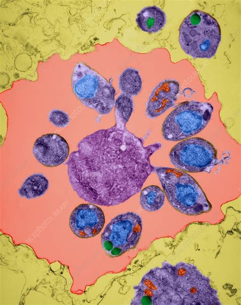 Plasmodium falciparum, TEM - Stock Image - C032/0947 - Science Photo ...