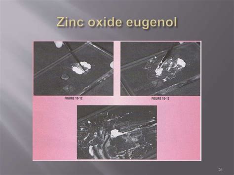 Zinc oxide eugenol