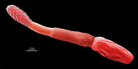 Multicellular Parasites - Types of Microbes