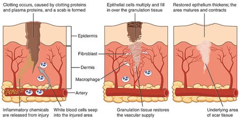 The Four-Stage Process of Wound Healing | Shop Wound Care