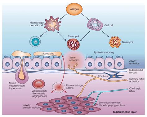 7: Schematic representation of asthma pathophysiology. Several ...