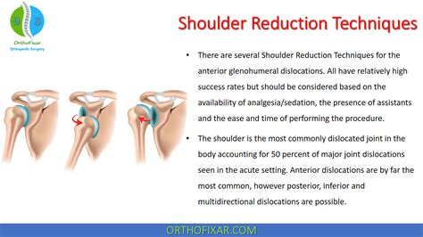 Shoulder Reduction Techniques | OrthoFixar 2024