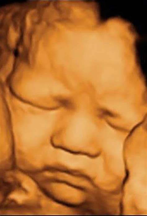 30 weeks pregnant 3d ultrasound - keryskill