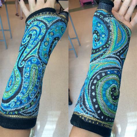 Decorated cast for a broken arm More Broken Wrist, Broken Foot ...