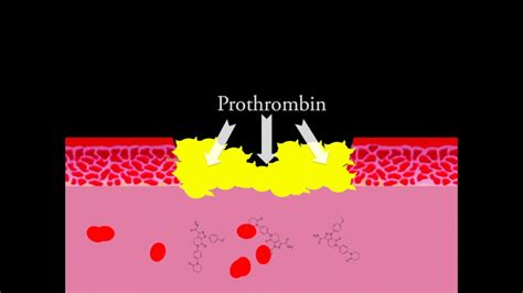 The Process of Blood Clotting- Animation - YouTube