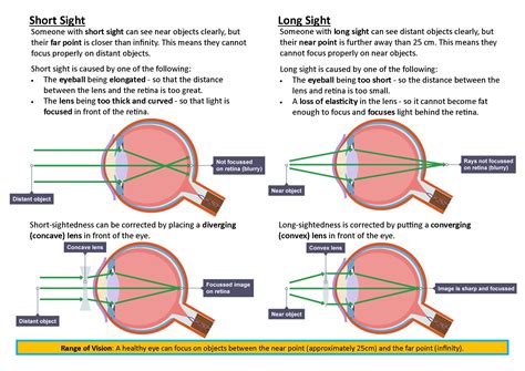 GCSE Physics Long Sight & Short Sight Poster | Teaching Resources