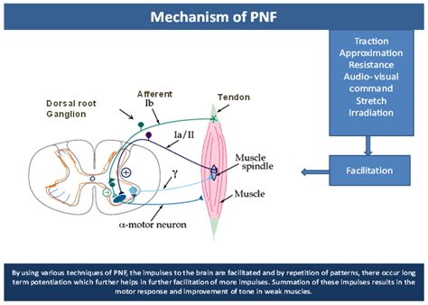 PNF in acute stroke - MedCrave online