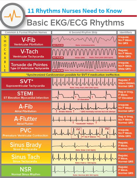 Free Ekg Practice Test And Answers