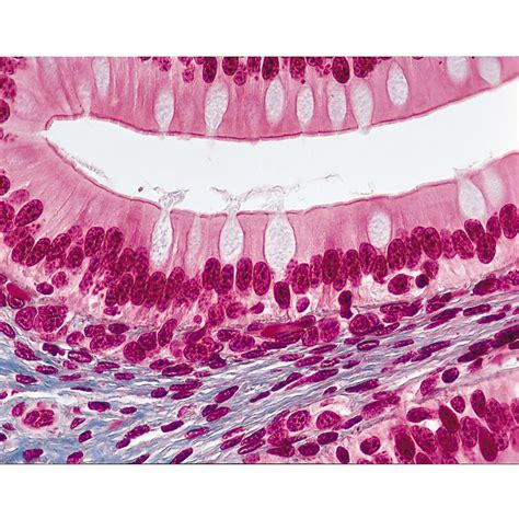 Amphibian Simple Columnar Epithelium, sec. 7 µm, Mallory's Stain ...