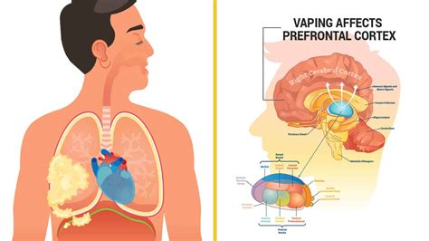 Researchers Reveal How Vaping Causes Brain and Lung Damage