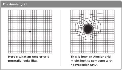 Florida Vision Institute | Wet vs Dry Macular Degeneration