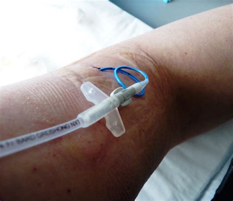 Living with Cancer: PICC Line Dressing Change