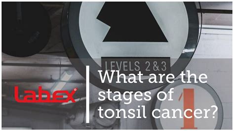 What are the stages of tonsil cancer? | by Laryngectomy | Medium