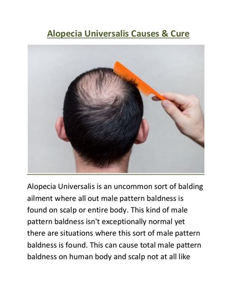 Alopecia universalis causes and treatment