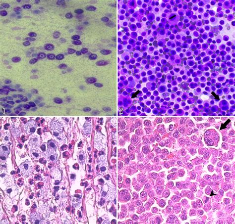 Photomicrography of mast cell tumors, skin, dog. (1) Low-grade mast ...