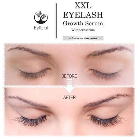 Diy Eyelash Growth Serum Before And After - Health Secrets: Latisse an ...