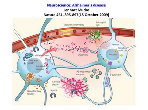 Using Pathway Studio in Neurodegenerative disease