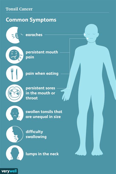 Lingual Tonsil Cancer Symptoms