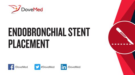 Endobronchial Stent Placement