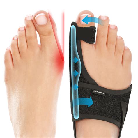 Best Bunion Corrector: Top 5 Products for Pain Relief - Pixelfy blog