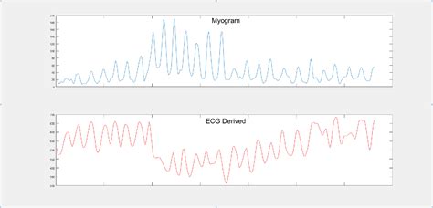 Figure 1 from ECG derived Cheyne–Stokes respiration and periodic ...