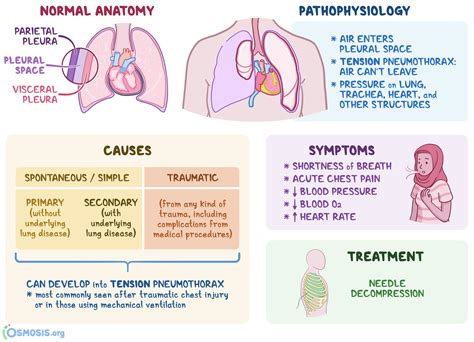 Tension Pneumothorax: What Is It, Causes, Signs | Osmosis