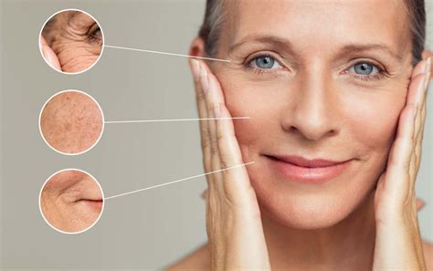 Fine Lines & Wrinkle Treatment - Complete Skin Solutions Rockhampton