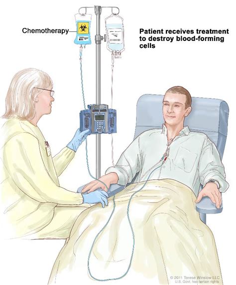 Leukemia Treatment Chemotherapy