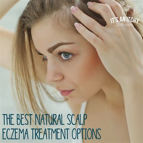 The Best Natural Scalp Eczema Treatment | It's an Itchy Little World