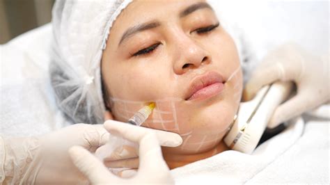 Mesotherapy – NOVIS Dermatology Klinik Kecantikan Bekasi