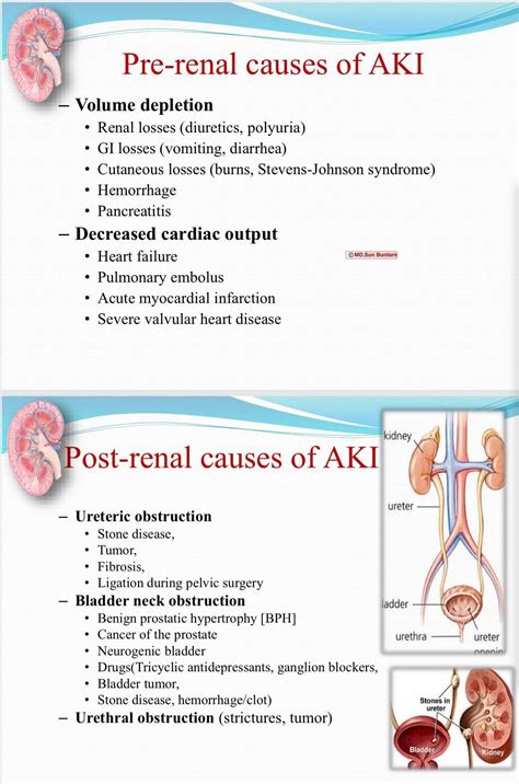 Pin on Acute kidney injury