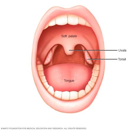 Lingual Tonsil Cancer Symptoms