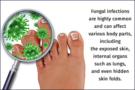 Fungal Types