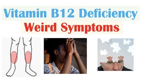 Vitamin B12 Deficiency, Causes, Signs, Symptoms, Diagnosis,