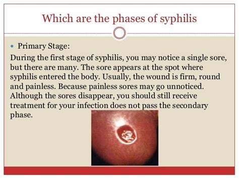 Syphilis