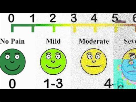 pain scale meme - roger-kerr