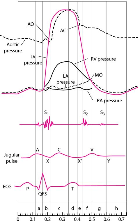 Cardiac Catheterization - Cardiovascular Disorders - Merck Manuals ...