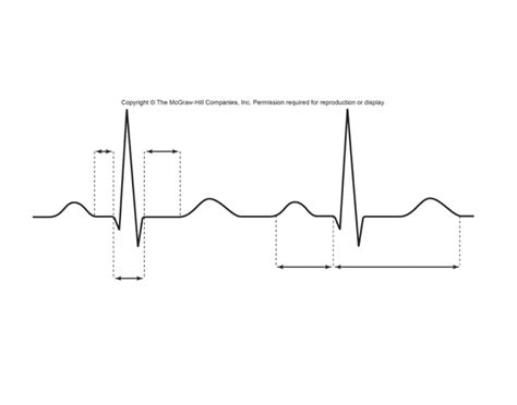 Cardiac Cycle: Electrocardiogram Quiz