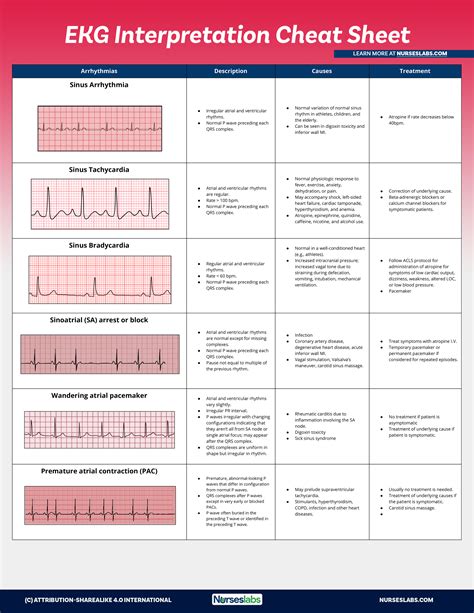 practice ekg rhythm strips for acls