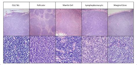 The histology of low-grade B-cell lymphomas, at Â4 and Â40 ...