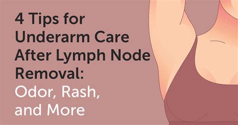 4 Tips for Underarm Care After Lymph Node Removal: Odor, Rash, and More ...