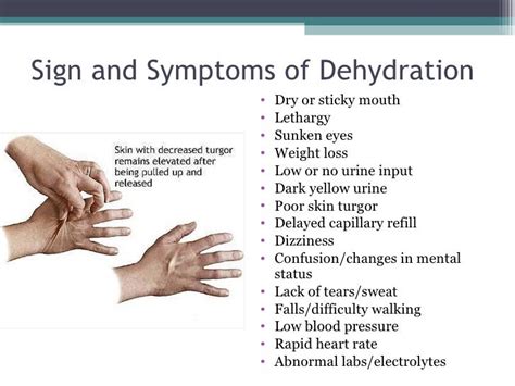 Dehydration And Enteral Feedings