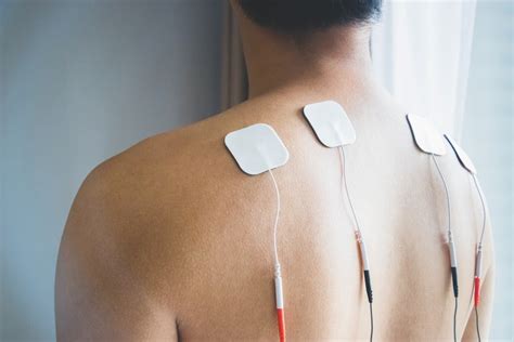 Neurostimulation devices gain traction in pain management applications