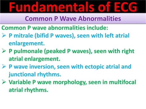 P wave abnormalities in ECG