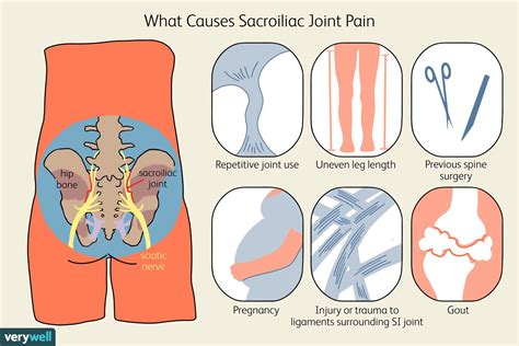 Pelvic Pain During Pregnancy: Causes, Diagnosis, and Treatment