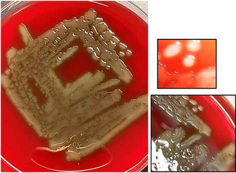 Streptococcus Pneumoniae Colony Morphology