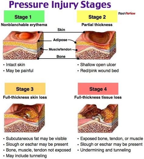 Pressure Injury Stages | Pressure ulcer staging, Nursing school tips ...