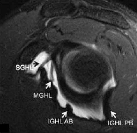 Glenohumeral Ligament Mri