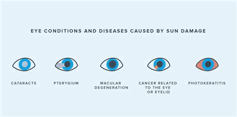 How Does the Sun Damage Our Eyes? | Warby Parker